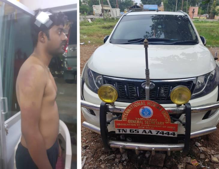 தூத்துக்குடியில் பயிற்சி பல் மருத்துவரை கடத்தி தாக்கியதாக திமுக ஊராட்சி மன்ற தலைவர் கைது!

